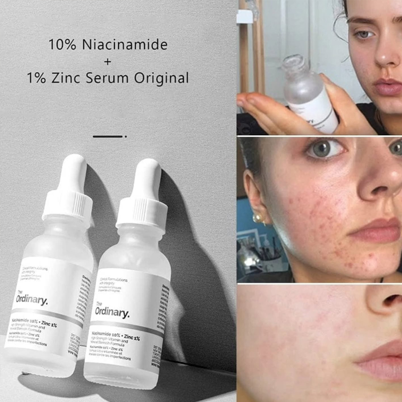 The Ordinary Niacinamida 10% + - Snail Mucin Essence reseña y precio